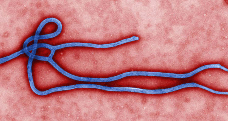 Ebola_virus_virion2